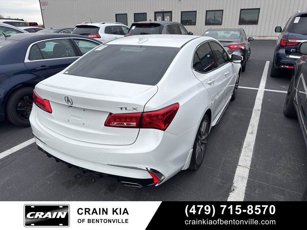 2020 Acura TLX 3.5L Technology Pkg - SUNROOF